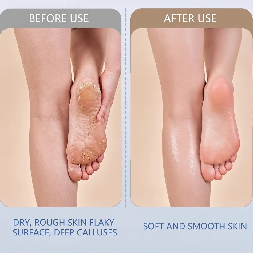Electric Pedicure Tool - Image 5